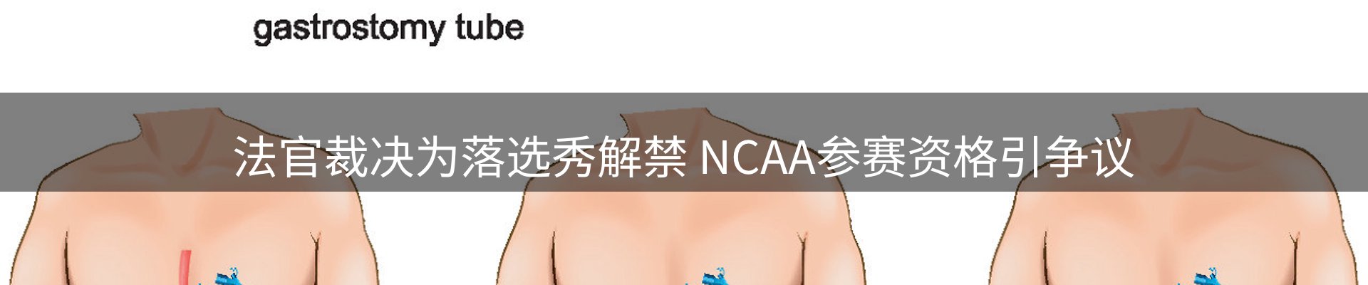 动态播报